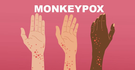 The Disastrous Case of Monkeypox